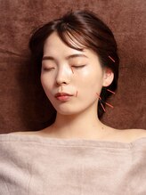 シー バイ カリスタ 銀座一丁目店(C by CALISTA)/最小限の鍼で最大限の効果を