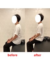 ナオル整体 福岡香椎院(NAORU整体)/30代男性施術事例【猫背】
