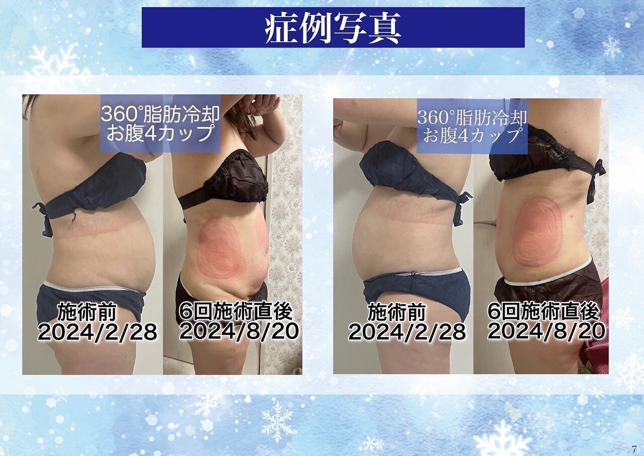 クールスパ(COOL SPA)｜ホットペッパービューティー