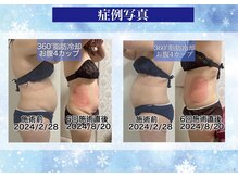 クールスパ(COOL SPA)の雰囲気（3回以上継続で効果期待◎ホームケアーは水分とマッサージのみ）