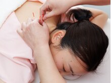 縁の雰囲気（辛い首肩コリもご相談ください。鍼灸初めての方も大歓迎です！）