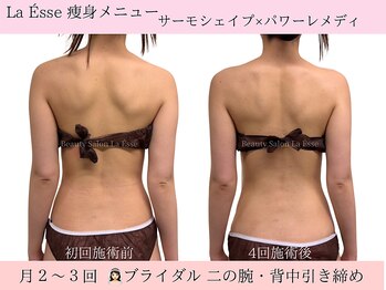 ラエッセ(La Esse)/ブライダル・肩甲骨