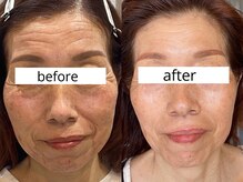 ボン セジュール(Bon sejour)/お仕上がり確認