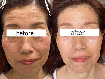 ボン セジュール(Bon sejour)/お仕上がり確認