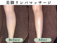 スイスパ 恵比寿(翠SUI SPA)/【美脚マッサージ】Before/After