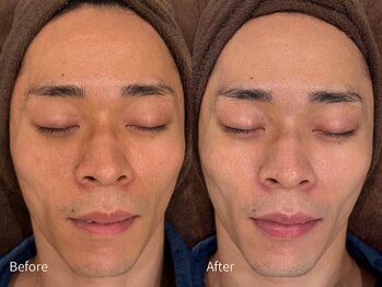 アウラ 小杉店(AULA)/ララピール☆