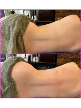 リセットモア(Reset More)/根本改善スペシャルにて