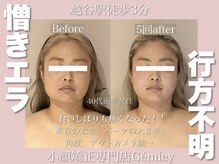 ジェイミー(Gemiey)