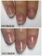ラピスネイル(Lapis Nail)の写真/爪を育成したいあなたへ!手足の爪のお悩みに寄り添い、自信に変わる場所◎♪(39文字)