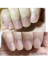 シャルム 本厚木(charme)/自爪育成コース (クリア仕上げ)