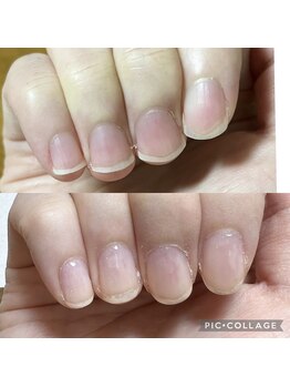 シャルム 本厚木(charme)/自爪育成コース (クリア仕上げ)