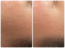 クランシュプール 恵比寿店/【肩コリ/ツヤ肌】