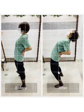 門前仲町イエティ鍼灸整骨院（旧：イエティ鍼灸整骨院）/ビィフォーアフター☆