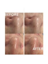 ディアー(Dear)/ハイドロスプラッシュ