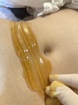 ララルアナ(Lara luana)/VIO脱毛で清潔感UP