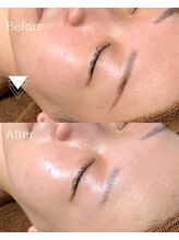 プレジール(plasir)/憧れの水光肌へ♪