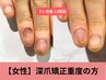 【お試し】女性●深爪矯正深刻な爪悩みの方￥23100→