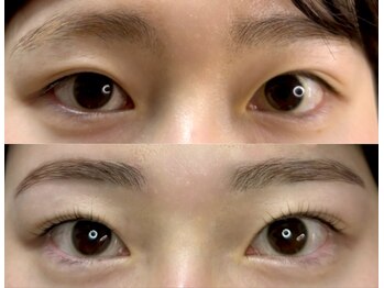 ノズ(NOZ)/眉毛まつ毛BeforeAfter