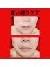 【人気♪】食いしばり/顎関節ケア/顎顔の疲労～20分　￥2980
