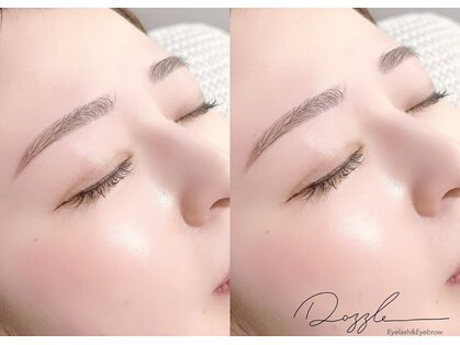 ダズル(DAZZLE)の写真