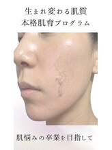 サロン イナンナ(Salon INANNA)&nbsp;毛穴レスな 水光肌に♪