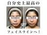 小顔頭蓋骨矯正+リンパケア8回コース ¥72,000→¥48,800