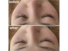 メナードフェイシャルサロン 岐阜茜部/クリーンパック