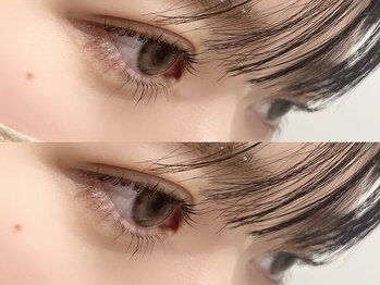 リティ(Lety)/逆まつげでお悩みのあなたへ