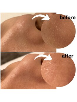 アンドモア(&more)/毛穴ケアは人気No1!