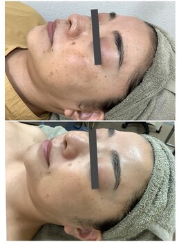 プリマプリート 岐阜店/韓国式肌管理(LDM)