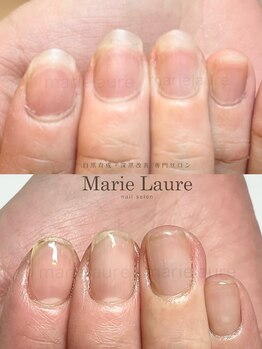 マリーロール 淀屋橋本店(Marie Laure)/自爪育成/深爪矯正/ネイルケア