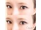 シュエット(Chouette)の写真