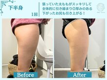 フローフシ∞/【痩身】下半身・お尻の脂肪撃退