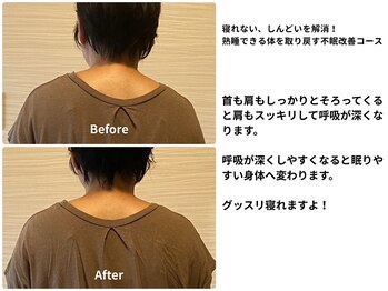 テルケル 佐賀/