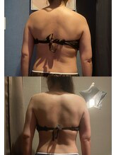 優来 神田店/肩甲骨施術の例