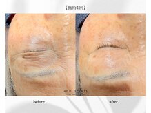 アン ビューティー(ann beauty)の雰囲気（【男女】パーツ美容の最先端!《エステ版ヒアル導入コース》）