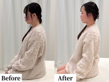 ソレア(Solea)/首こり・肩こり・頭痛改善1回目