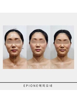 ケイビューティーサロン(K BeautySalon)/韓国本場リガメントコルギ