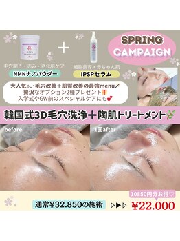 クレヴィー(Creviy)/キャンペーン