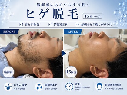 アールビューティー(R Beauty)の写真