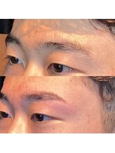 眉毛ハウス 吉祥寺店(眉毛HOUSE)/お客様の施術例(吉祥寺/東京)