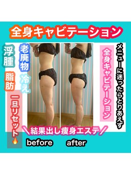 ビューティ ウィッチ(Beauty Witch)/