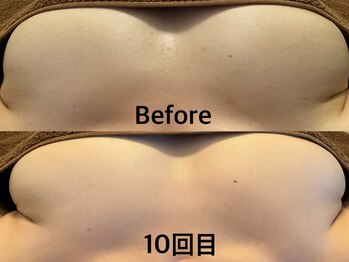 整顔整頭/スタンダードバストケア（10回）