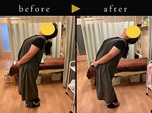 杉本接骨鍼灸院/背骨から全身がユルユル整体