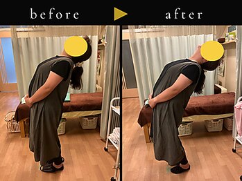 杉本接骨鍼灸院/背骨から全身がユルユル整体