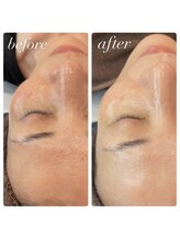 ラディエンス 多治見店/リアボーテマーメイドセルエステ