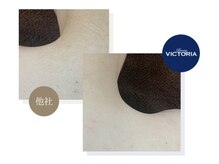 タスク(Tasuku.)/見える箇所の脱毛