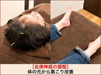 A1スポーツマッサージ治療院/【肩こり整体】自律神経調整