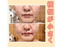 オプレア 栄店(OPREA)の雰囲気（1回でも効果実感がある【小顔コルギ】）