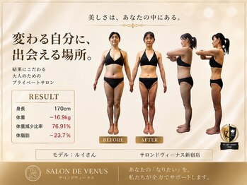 エステティックサロン サロン ド ヴィーナス 新宿店/ビフォアフター